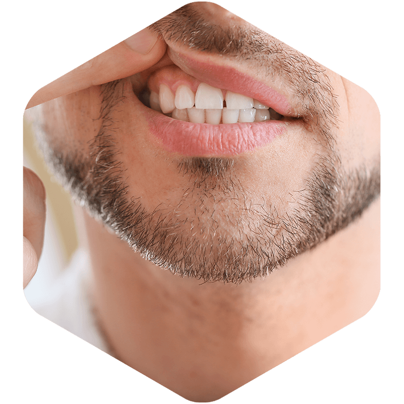 Patient with Gum Diseases.