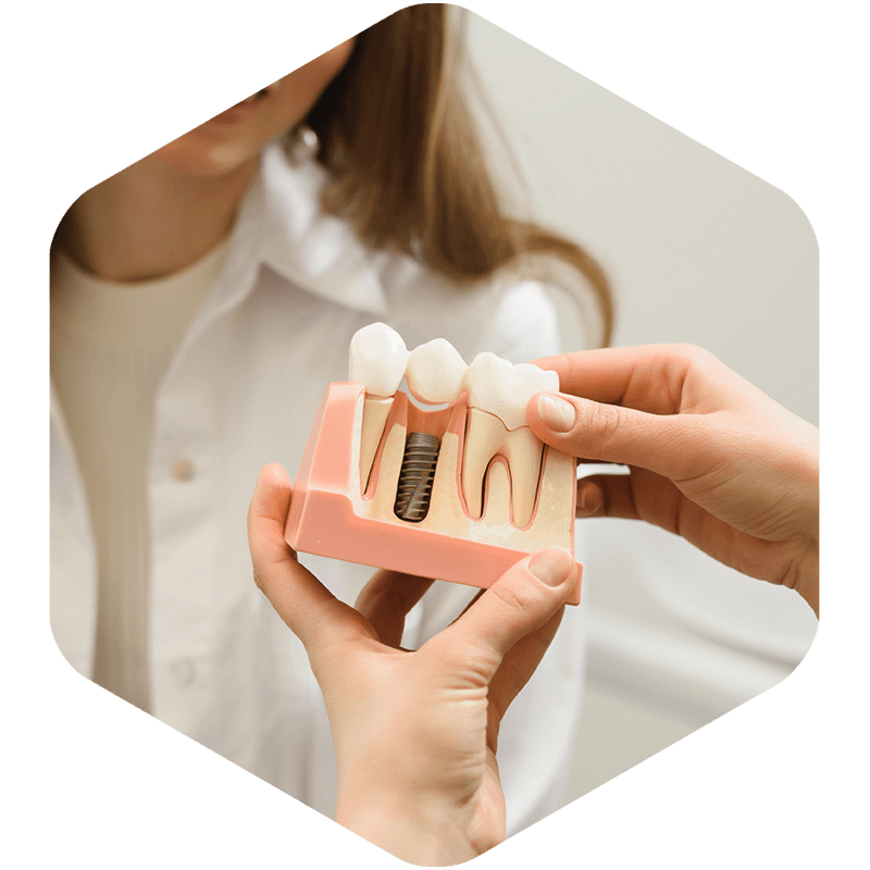 Dentist showing implants to patient