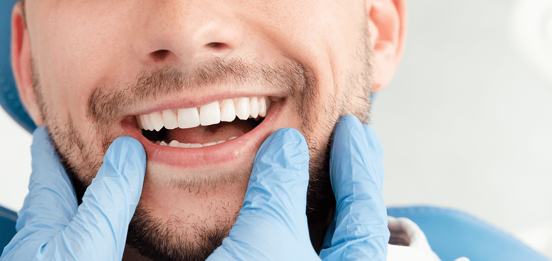 A patient with beautiful set of teeth
