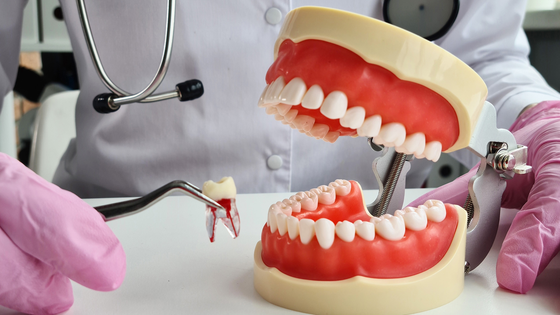 Dentist performing tooth extraction with denture model.